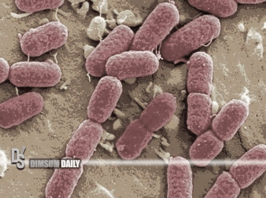 Oneyearold boy infected with Shiga toxinproducing Escherichia coli