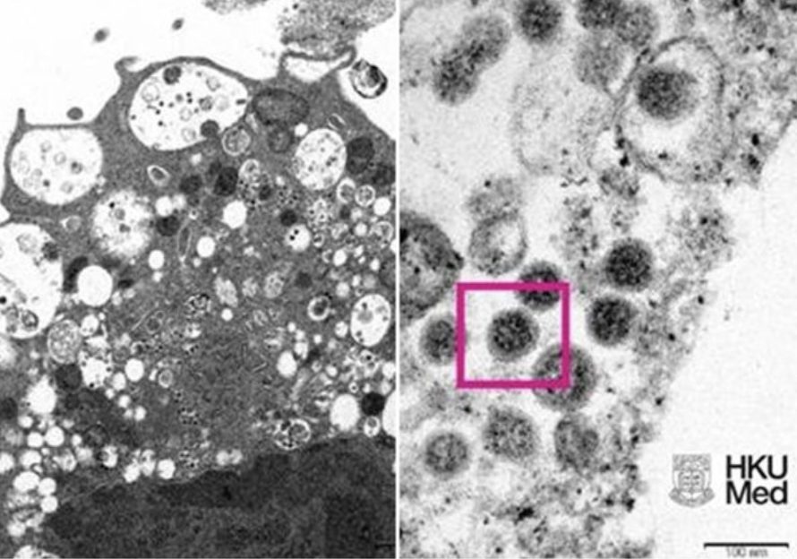 Pictures of Omicron variant virus under microscope released by HKU