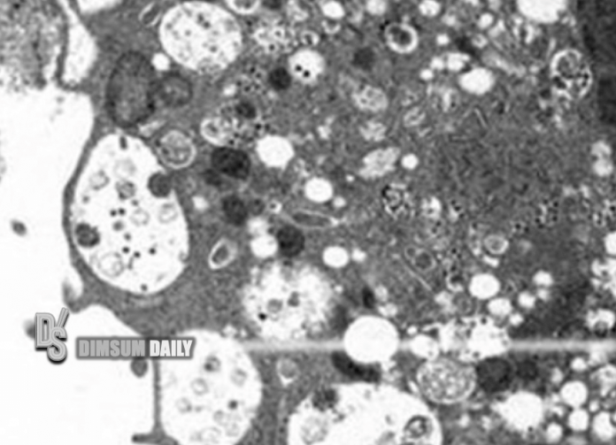 Pictures of Omicron variant virus under microscope released by HKU