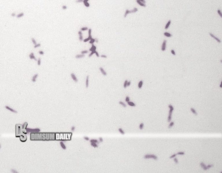 CFS finds excessive Bacillus cereus in fried rice sample from Shanghai