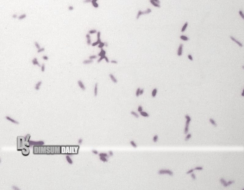 CFS finds excessive Bacillus cereus in fried rice sample from Shanghai ...