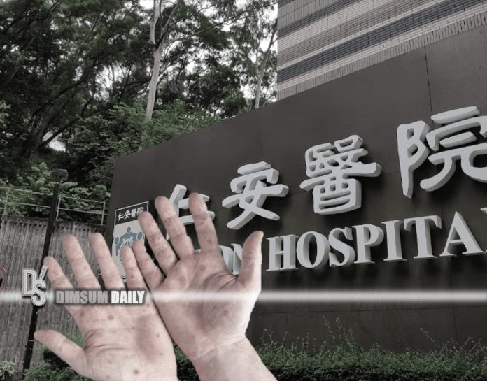 Hong Kong confirms another case of Monkeypox involving 35-year-old male ...