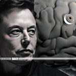 Elon Musk’s Neuralink successfully implants brain device in first human trial