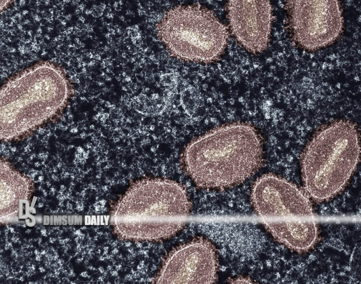 U.S. confirms first case of clade I mpox in California