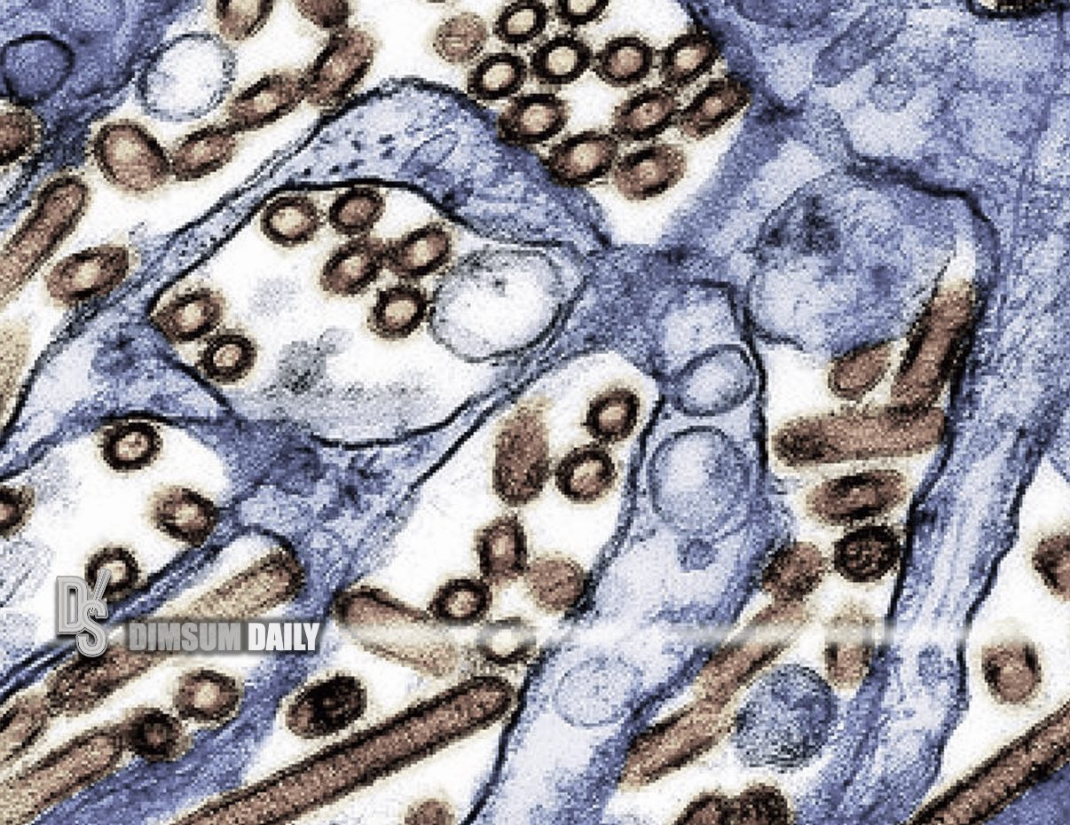 First severe human case of bird flu confirmed in the U.S. linked to ...