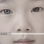 Seven-year-old girl with heterochromia gains unexpected support from classmates