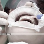 Unregistered female dentist arrested for teeth whitening in Lai Chi Kok