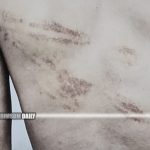 Rescued Hong Kong man reveals daily 17-hour work shifts and physical abuse in Myanmar scam operation